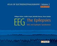 Produktbild: Atlas of electroencephalography Volume 2 : The Epilepsies. 2ED