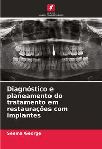 Produktbild: Diagn&oacute;stico e planeamento do tratamento em restaura&ccedil;&otilde;es com implantes