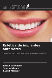 Produktbild: Est&eacute;tica de implantes anteriores