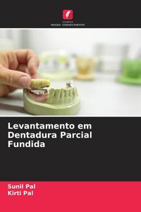 Produktbild: Levantamento em Dentadura Parcial Fundida