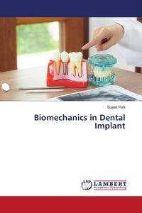 Produktbild: Biomechanics in Dental Implant