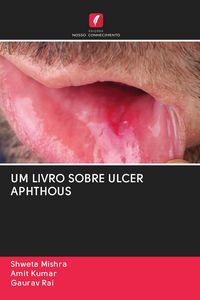 Produktbild: Um Livro Sobre Ulcer Aphthous