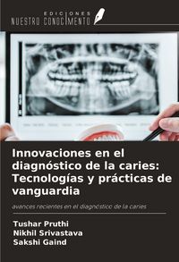 Produktbild: Innovaciones en el diagn&oacute;stico de la caries: Tecnolog&iacute;as y pr&aacute;cticas de vanguardia