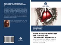 Produktbild: Nicht-invasive Methoden der Fibrose bei chronischer Hepatitis B