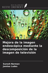 Produktbild: Mejora de la imagen endosc&oacute;pica mediante la descomposici&oacute;n de la imagen de televisi&oacute;n