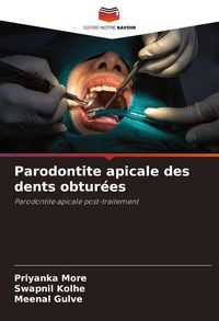 Produktbild: Parodontite apicale des dents obtur&eacute;es