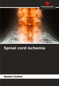 Produktbild: Spinal cord ischemia
