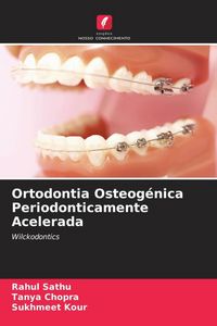 Produktbild: Ortodontia Osteog&eacute;nica Periodonticamente Acelerada
