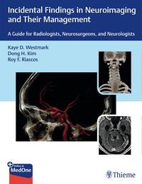 Produktbild: Incidental Findings in Neuroimaging and Their Management