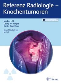 Produktbild: Referenz Radiologie - Knochentumoren