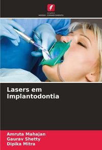 Produktbild: Lasers em Implantodontia