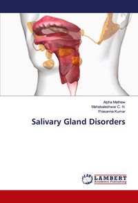 Produktbild: Salivary Gland Disorders
