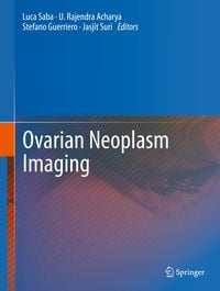 Produktbild: Ovarian Neoplasm Imaging