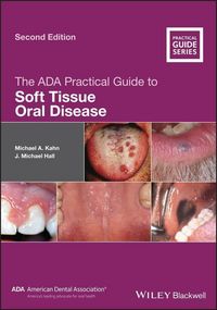 Produktbild: The ADA Practical Guide to Soft Tissue Oral Disease