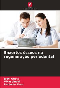 Produktbild: Enxertos &oacute;sseos na regenera&ccedil;&atilde;o periodontal