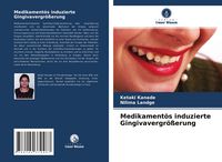 Produktbild: Medikament&ouml;s induzierte Gingivavergr&ouml;&szlig;erung