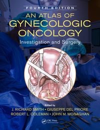 Produktbild: An Atlas of Gynecologic Oncology