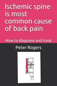 Produktbild: Ischemic Spine Is Most Common Cause of Back Pain: How to Diagnose and Treat