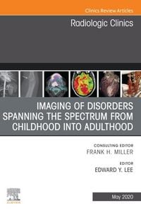 Produktbild: Imaging of Disorders Spanning the Spectrum from Childhood ,An Issue of Radiologic Clinics of North America E-Book