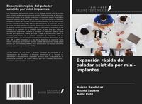 Produktbild: Expansi&oacute;n r&aacute;pida del paladar asistida por mini-implantes