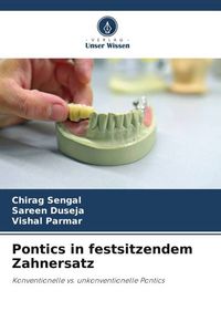 Produktbild: Pontics in festsitzendem Zahnersatz