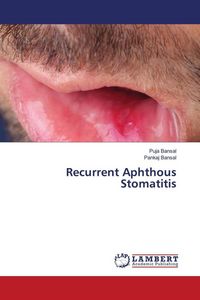 Produktbild: Recurrent Aphthous Stomatitis
