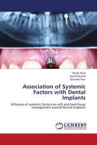 Produktbild: Association of Systemic Factors with Dental Implants