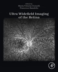 Produktbild: Ultra Widefield Imaging of the Retina