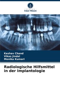 Produktbild: Radiologische Hilfsmittel in der Implantologie