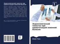 Produktbild: Jendoskopicheskij gemostaz pri krowotochaschej qzwennoj bolezni