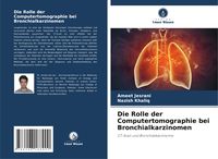 Produktbild: Die Rolle der Computertomographie bei Bronchialkarzinomen