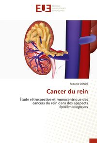 Produktbild: Cancer du rein