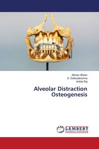 Produktbild: Alveolar Distraction Osteogenesis