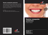 Produktbild: Resine composite posteriori