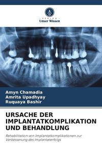 Produktbild: Ursache der Implantatkomplikation und Behandlung