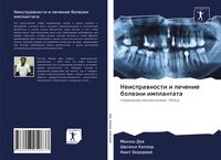 Produktbild: Neisprawnosti i lechenie bolezni implantata