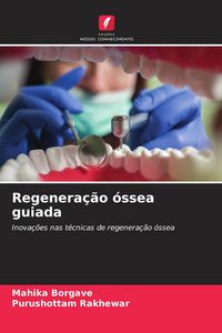 Produktbild: Regenera&ccedil;&atilde;o &oacute;ssea guiada