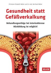 Produktbild: Gesundheit statt Gef&auml;&szlig;verkalkung