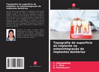 Produktbild: Topografia da superf&iacute;cie do implante na osteointegra&ccedil;&atilde;o de implantes dent&aacute;rios