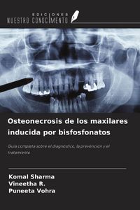 Produktbild: Osteonecrosis de los maxilares inducida por bisfosfonatos