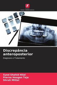 Produktbild: Discrep&acirc;ncia anteroposterior