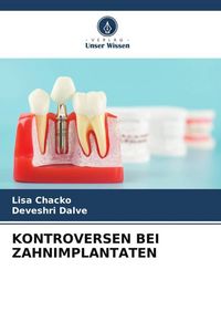 Produktbild: Kontroversen bei Zahnimplantaten