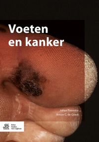 Produktbild: Voeten en kanker