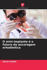 Produktbild: O mini-implante &eacute; o futuro da ancoragem ortod&ocirc;ntica