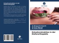 Produktbild: Eckzahnretraktion in der Kieferorthop&auml;die
