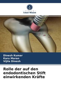 Produktbild: Rolle der auf den endodontischen Stift einwirkenden Kr&auml;fte