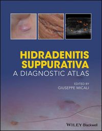 Produktbild: Hidradenitis Suppurativa