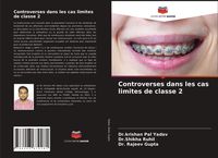 Produktbild: Controverses dans les cas limites de classe 2