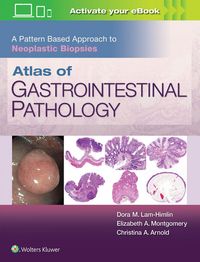 Produktbild: Atlas of Gastrointestinal Pathology: A Pattern Based Approach to Neoplastic Biopsies