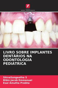 Produktbild: LIVRO SOBRE IMPLANTES DENT&Aacute;RIOS NA ODONTOLOGIA PEDI&Aacute;TRICA